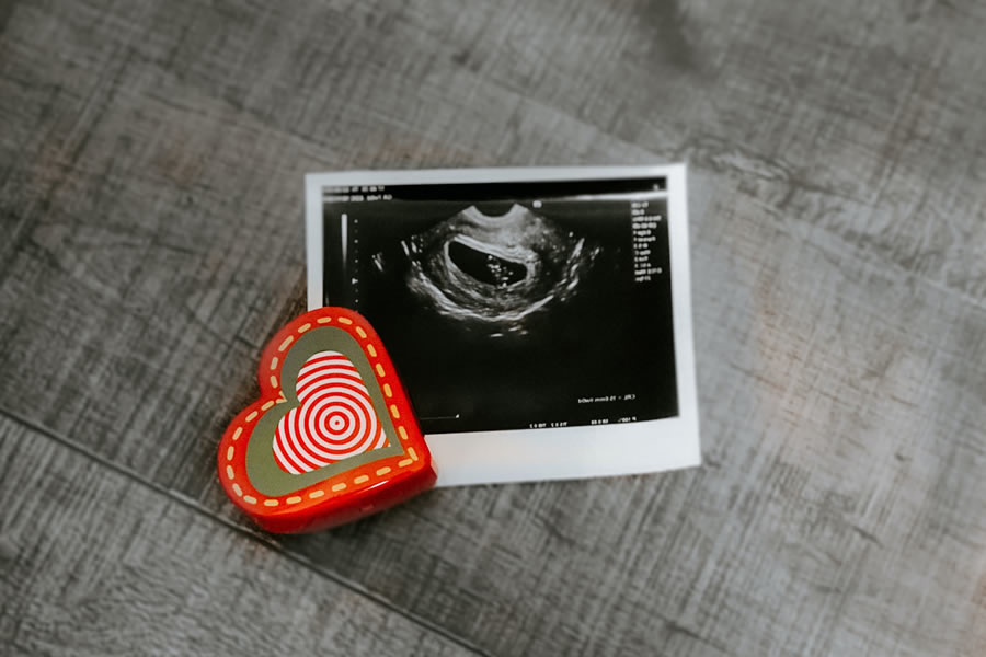 ultrasound2