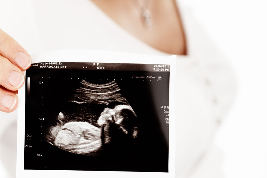 unborn